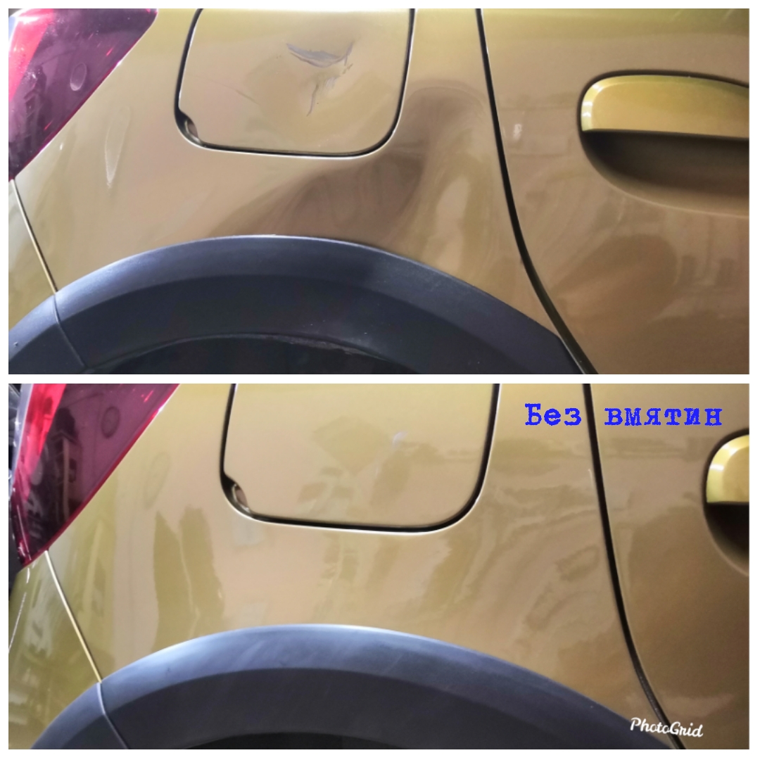 udalenie vmyatin grodno 011