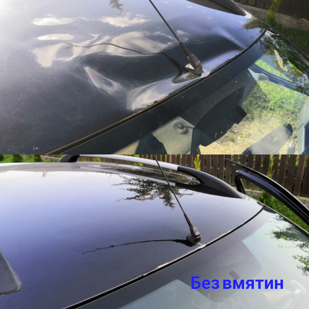 udalenie vmyatin grodno 012