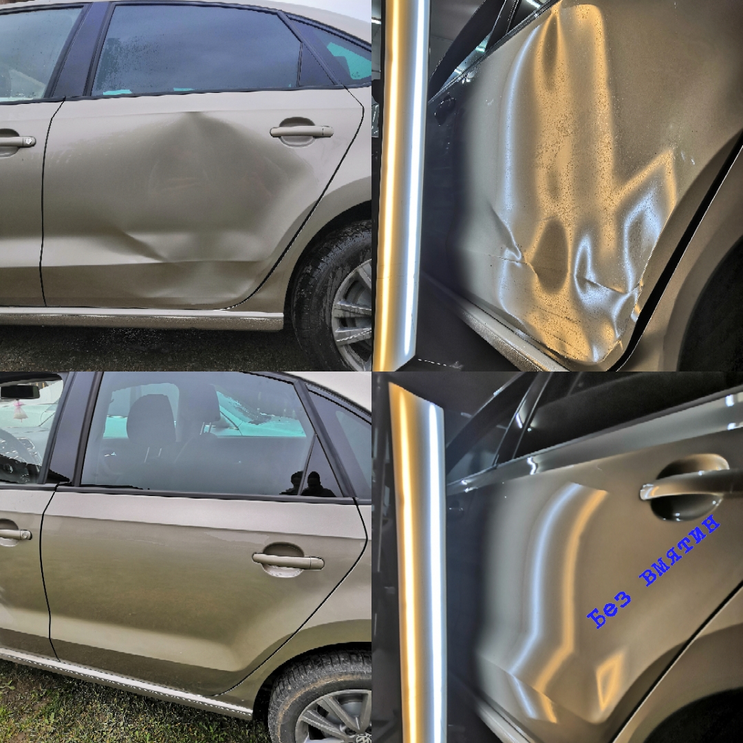 udalenie vmyatin grodno 014