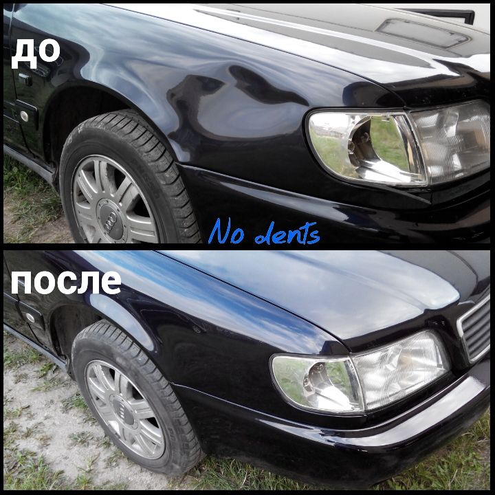 udalenie-vmyatin-grodno-19