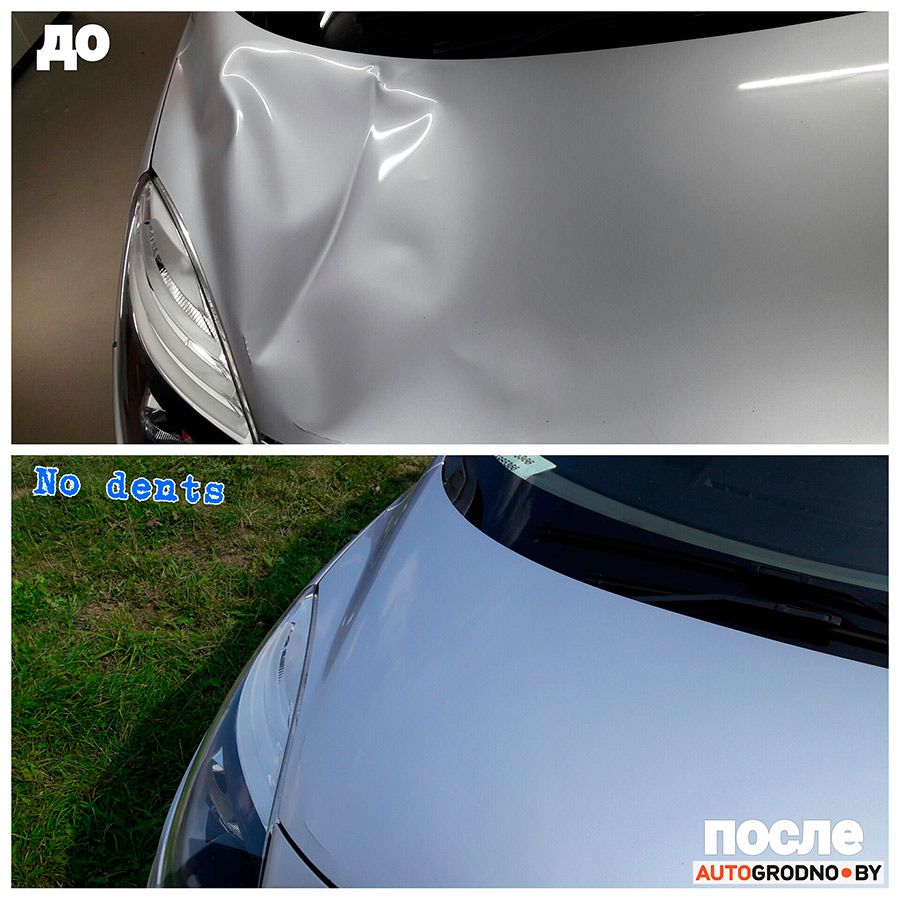 udalenie vmyatin grodno 20 1