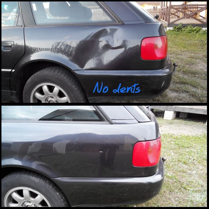 udalenie-vmyatin-grodno-20