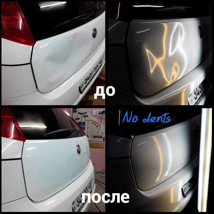 udalenie-vmyatin-grodno-24