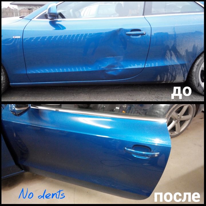 udalenie-vmyatin-grodno-25