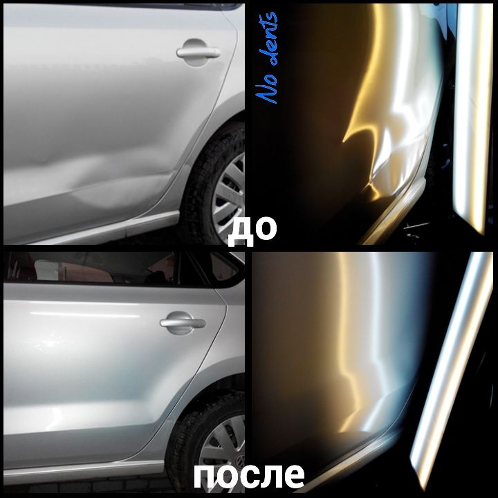 udalenie-vmyatin-grodno-26