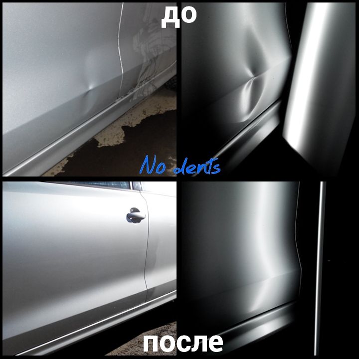 udalenie-vmyatin-grodno-27