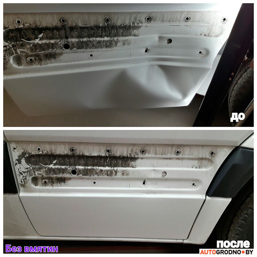 udalenie vmyatin grodno 33