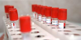 Информация о группе крови будет вноситься в белорусские паспорта и ВНЖ